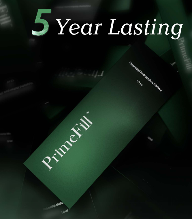 pmma injections cost