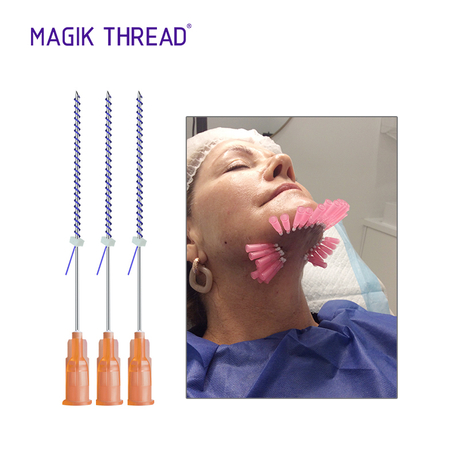 PDO Thread Lift Jawline Before and After.jpg