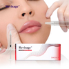 Lip Filler Price in Los Angeles: A Guide to Lip Filler Cost