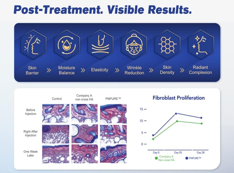 Clinical evidence of the superior efficacy of polynucleotide products