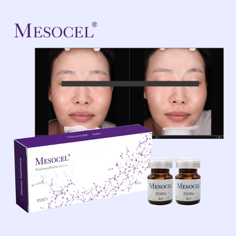 Mesocel PDRN Salmon Vial