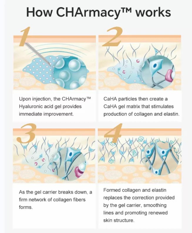 how calcium hydroxyapatite dermal filler work