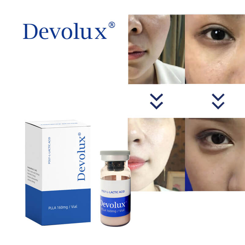 Stimulates Collagen Dermal Injection Poly Lactic Acid Filler