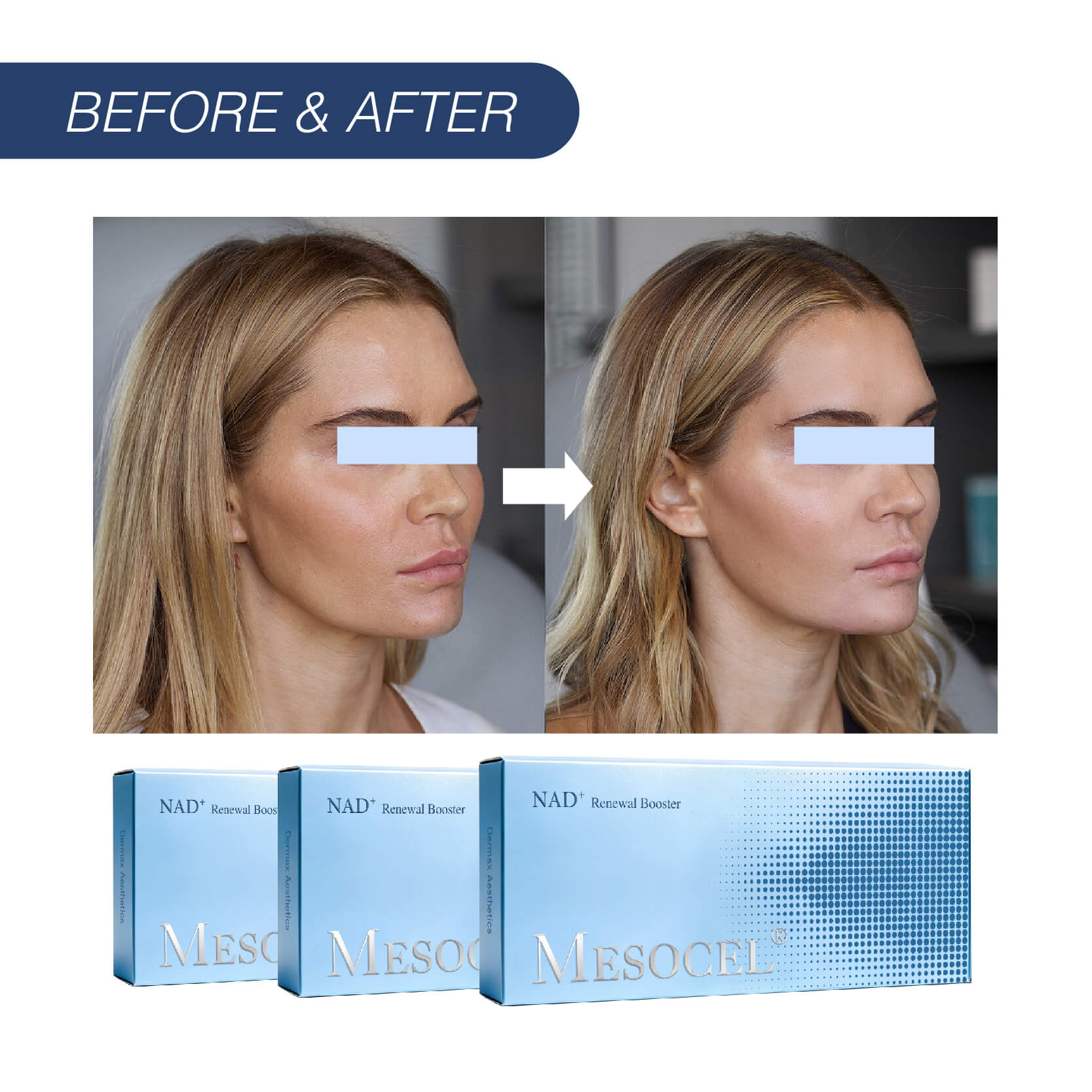 Mesocel&reg; NAD+ Renewal Booster 