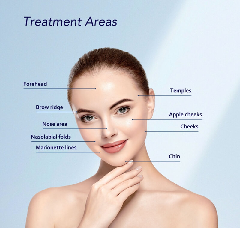 calcium hydroxyapatite stimulatory filler treatment areas