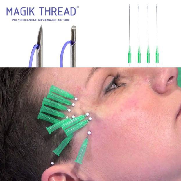 Am I suitable for PDO threads (1)