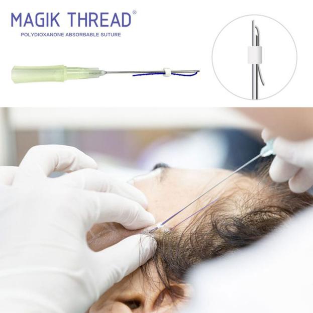 Am I suitable for PDO threads (4)