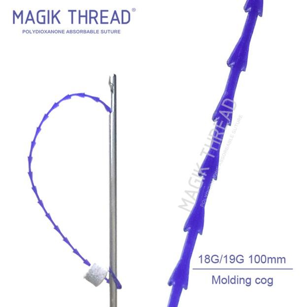 What is Magik pdo thread lift (2)
