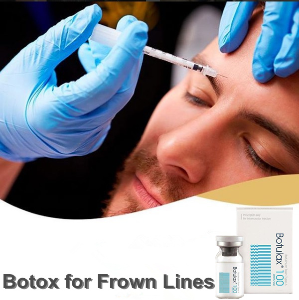 What To Do After Botulinum Toxin Type A Injection