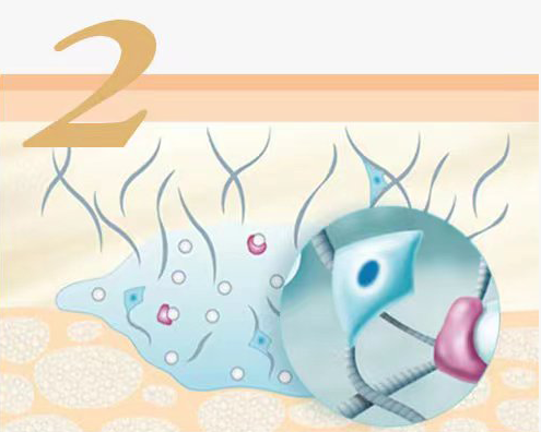 Calcium Hydroxylapatite Fillers Injections work