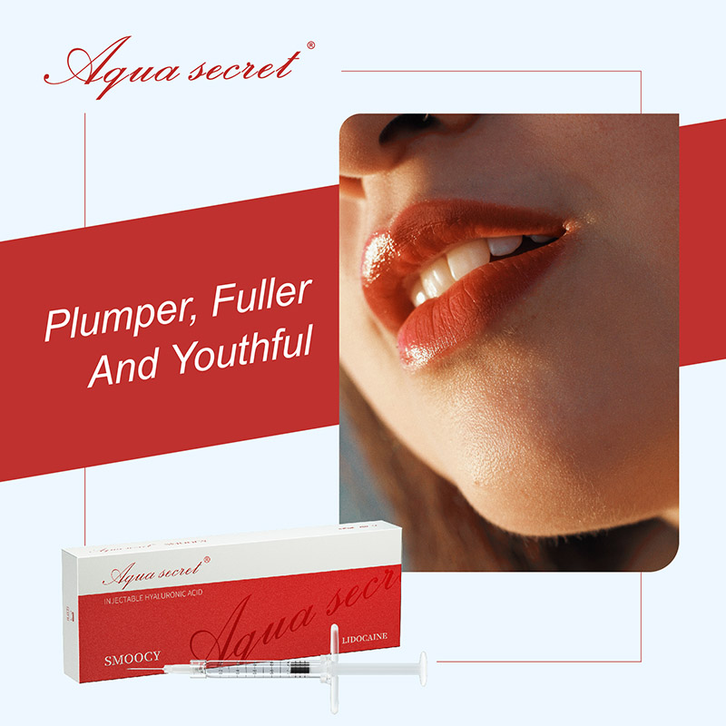 aqua secret Lip Fillers Improve a Gummy Smile