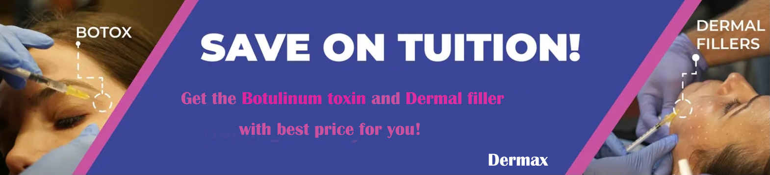 Botulinum Toxin and filler shopping 