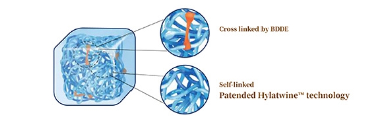 Macrolite dermal filler buttocks technology 2