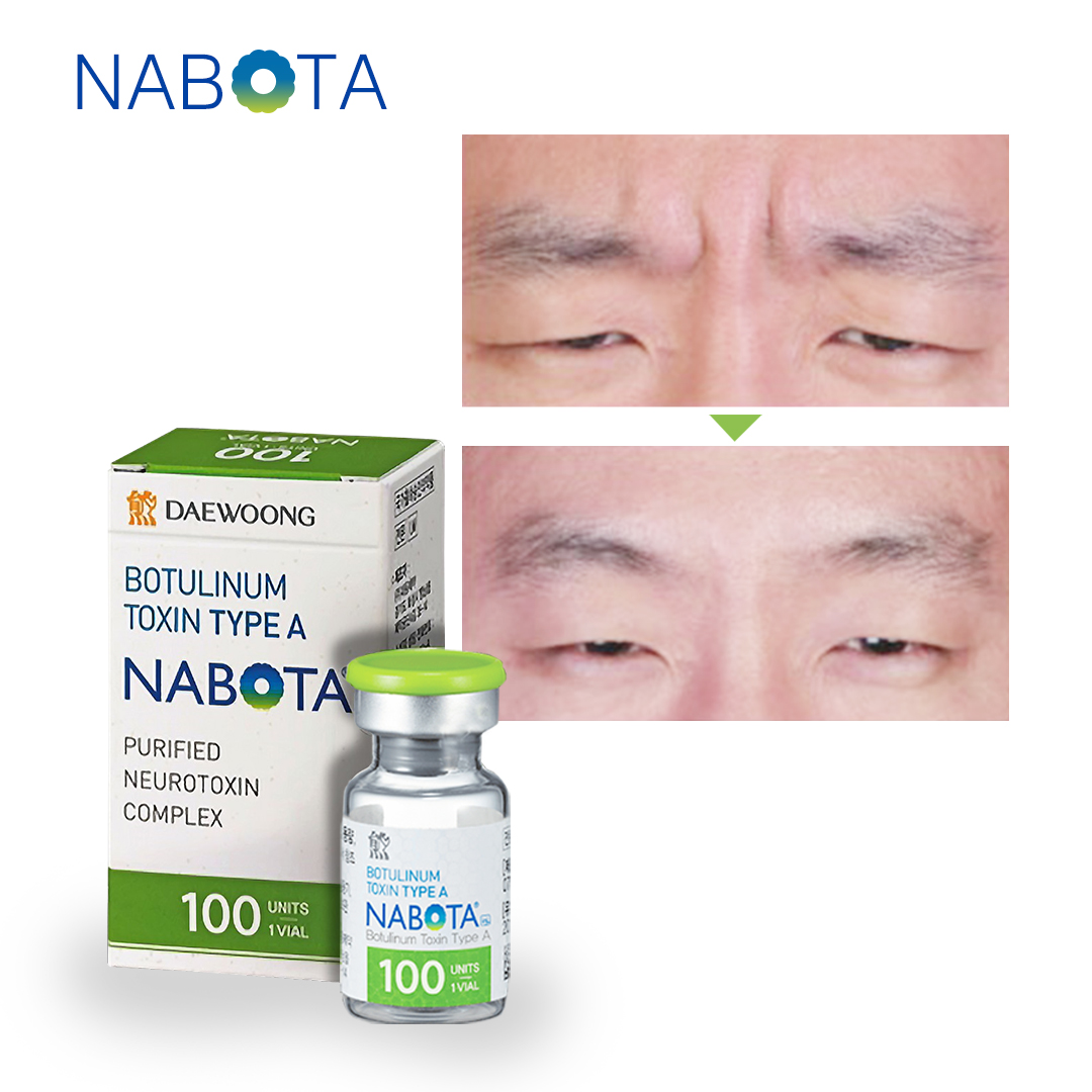 Korean Nabota Botulinum Toxin - Dermax