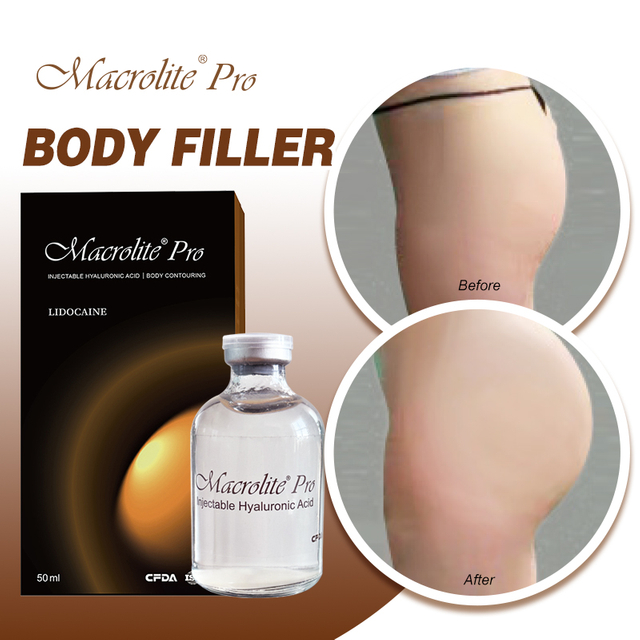 Macrolite® Pro Butt Injection Filler For Buttocks Enlargement