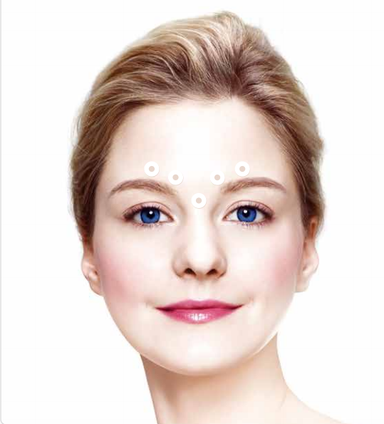 Nabota Botulinum Toxin Glabellar Injection Price