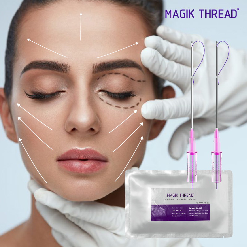 Magik Thread Suture Pdo Lifting Thread With Needles