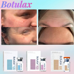 Dermax – Premium Botulax® Botulinum Toxin Wholesaler