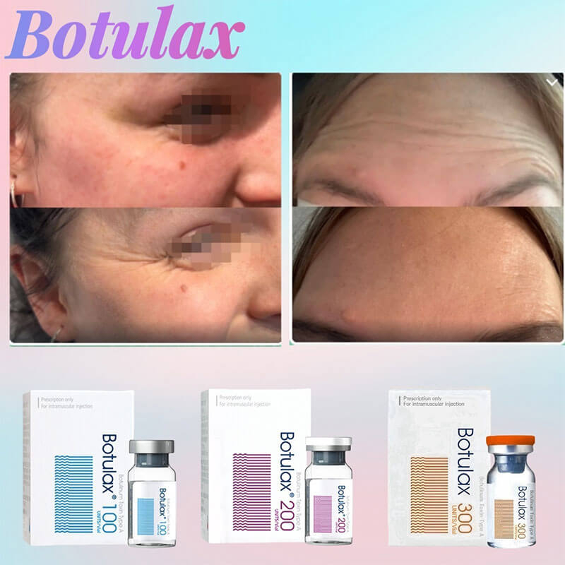 Dermax – Premium Botulax® Botulinum Toxin Wholesaler