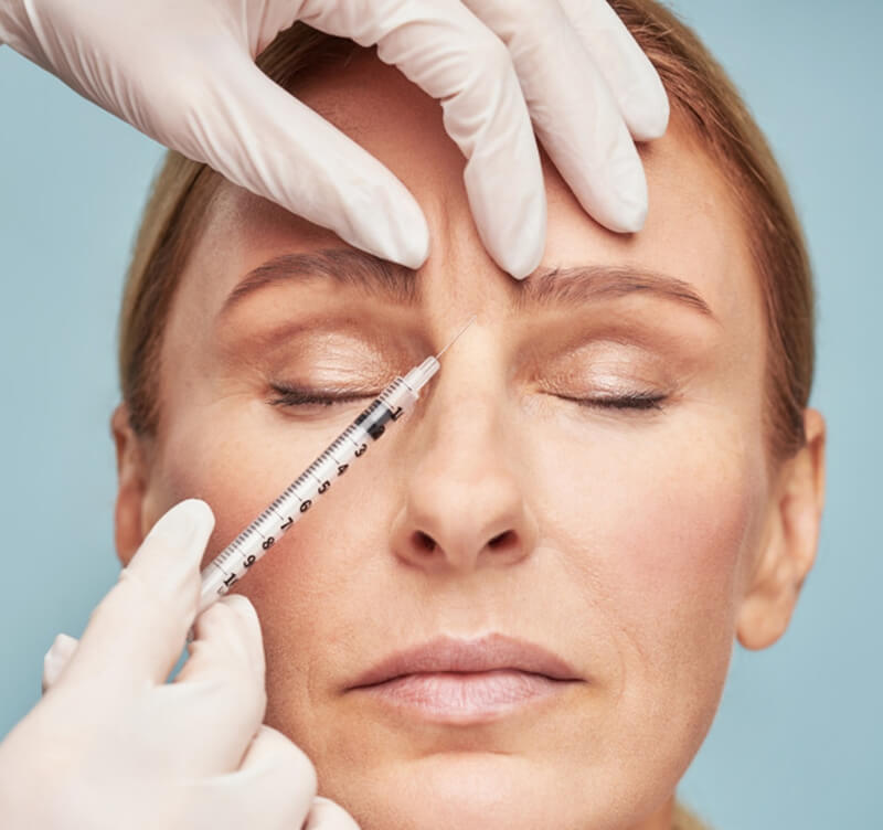 Glabellar Region injection