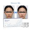 Mesocel® Hyaluronic Acid Skin Booster
