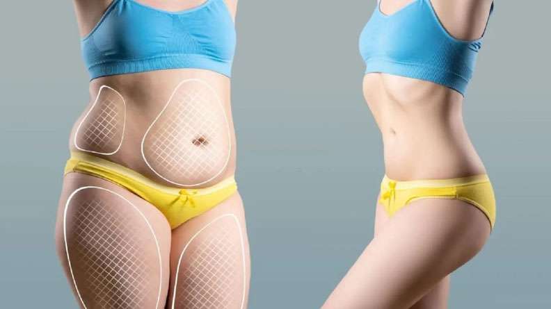 Belly Fat Dissolving Injections