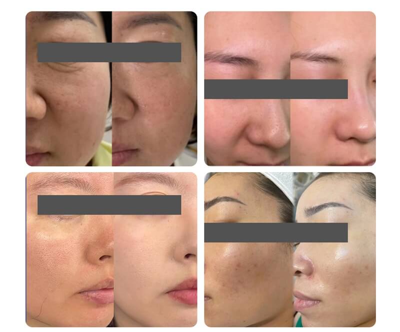 polynucleotides treatment before and after