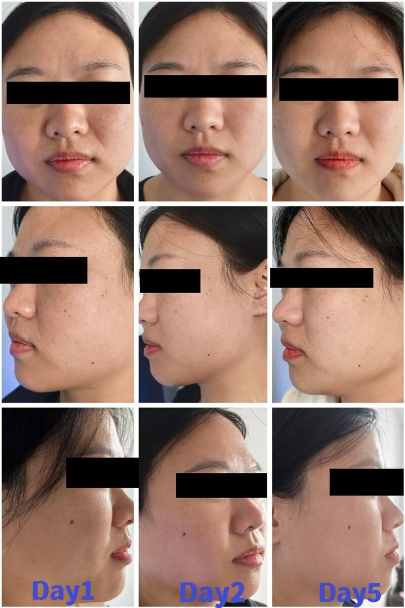 polynucleotides treatment before and after