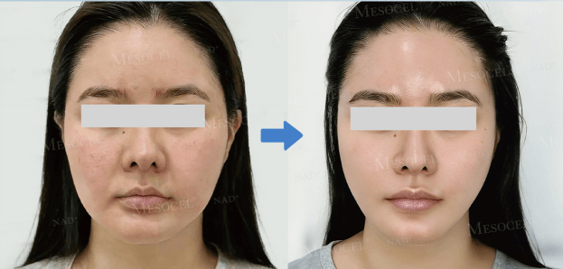 Mesocel&reg; NAD+ Renewal Booster