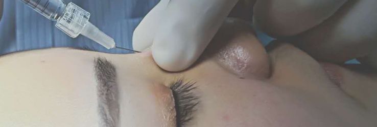 How Much Do HA Filler Cost?