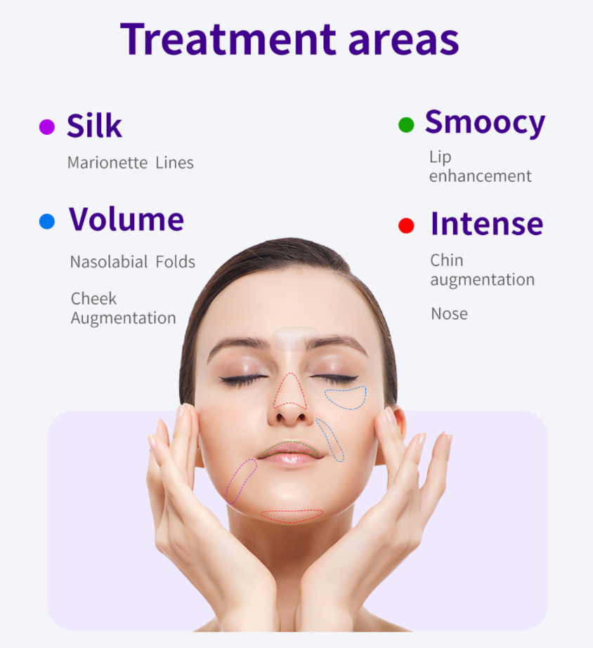 Juvensence Hyaluronic Acid - Best Dermal Filler For Face