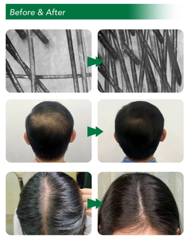 hair exosomes results