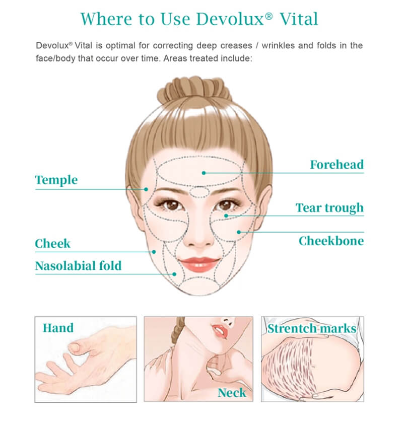 deovlux vital treatment areas