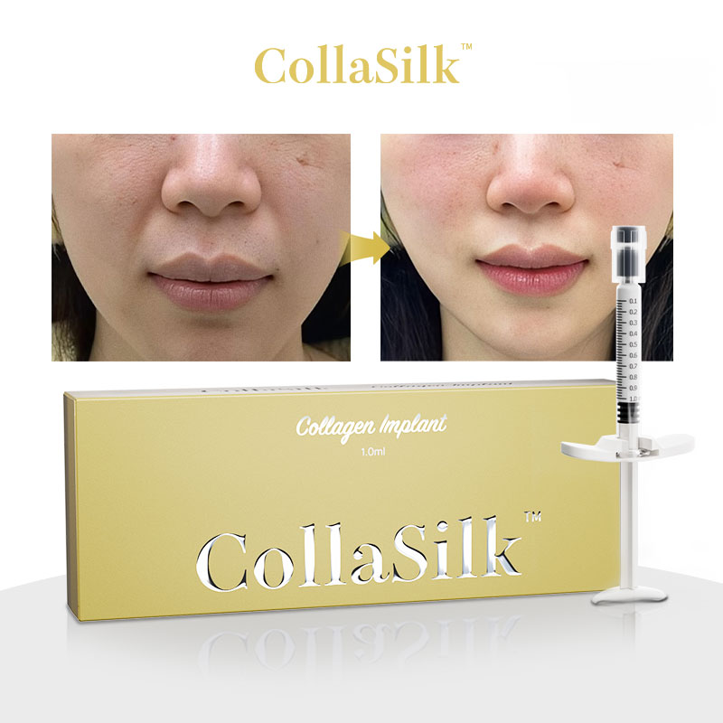 CollaSilk Injectable Collagen Filler