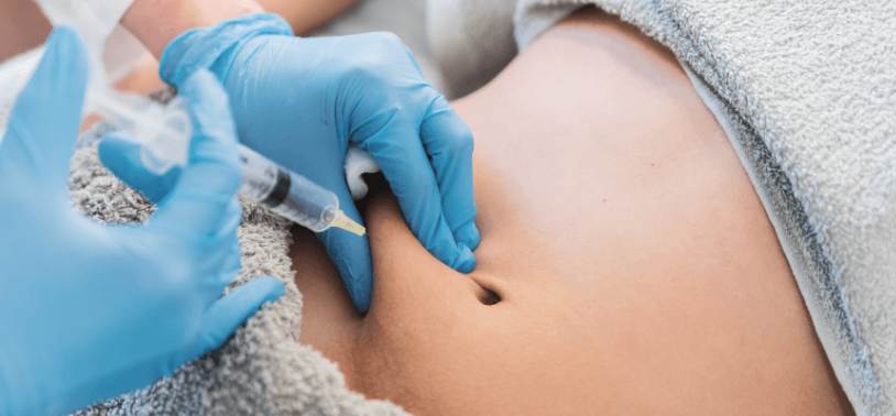 mesolipo before and after