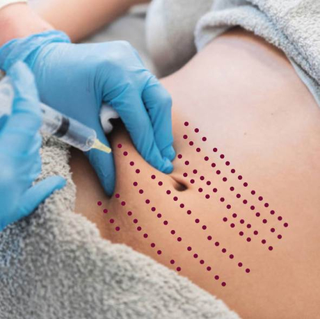 Mesolipo vs Mesotherapy.jpg