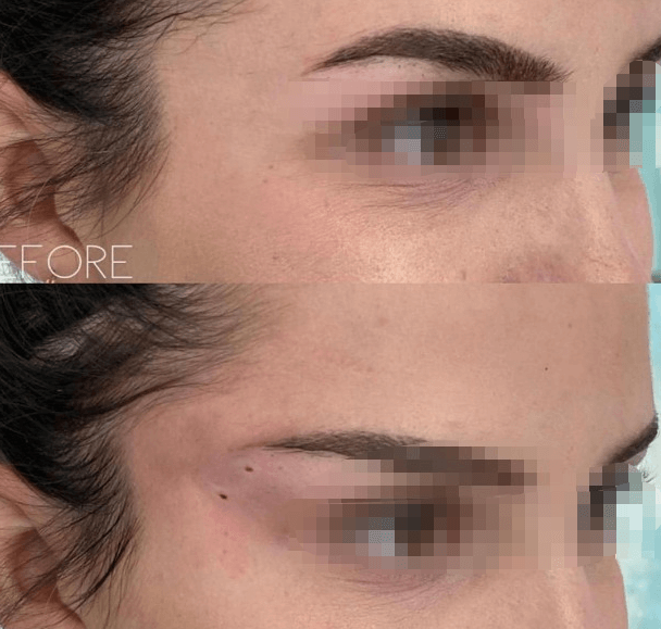 pdo mono threads before and after