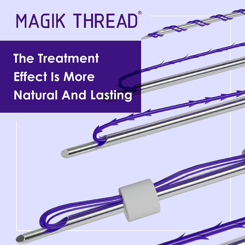 Magik Thread PDO THREAD.jpg