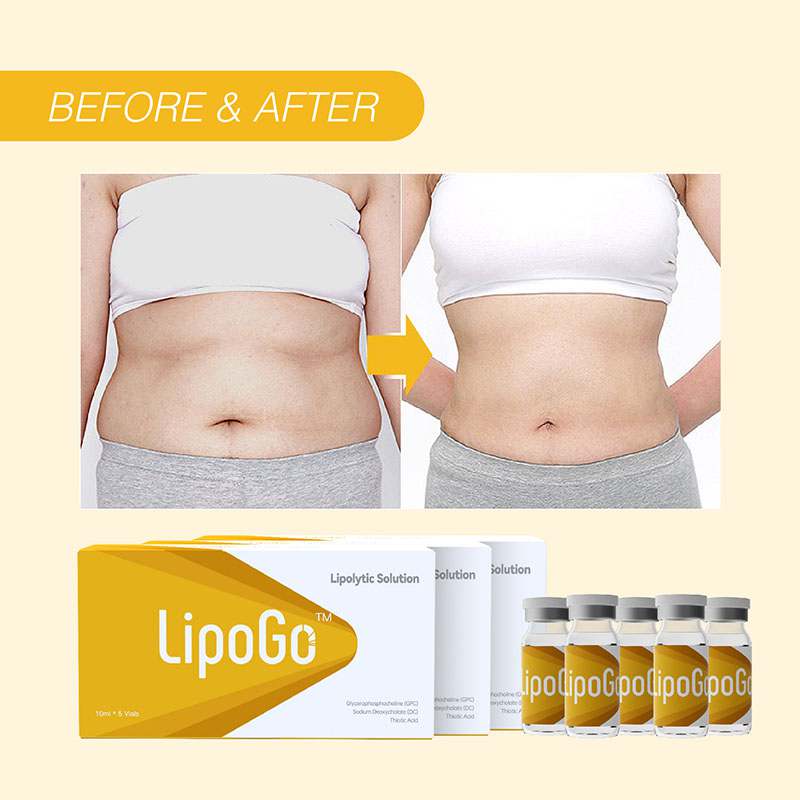 LipoGo Abdomen Fat Dissolving Injection