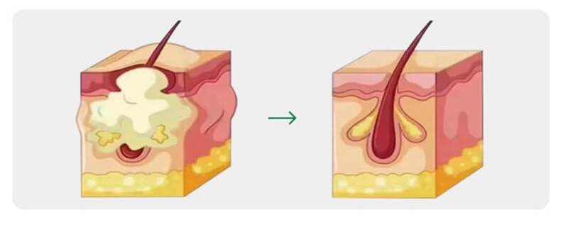 Immune Regulation & Anti-Inflammatory Action