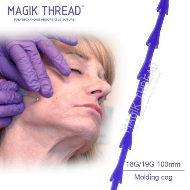 What can a PDO thread do for you (4)