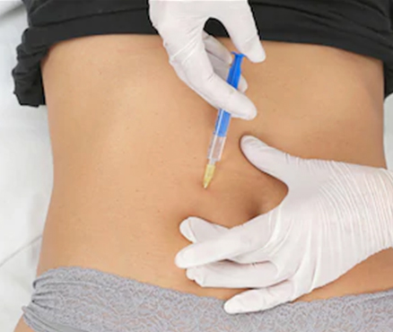 Injection into the abdomen