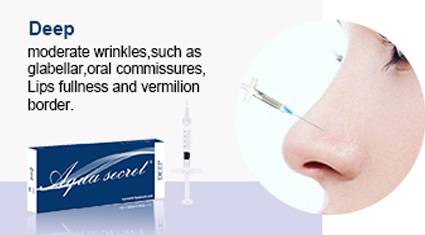 Which type to choose - Aqua Secret Deep