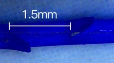 Magik PDO Thread Barb Distance