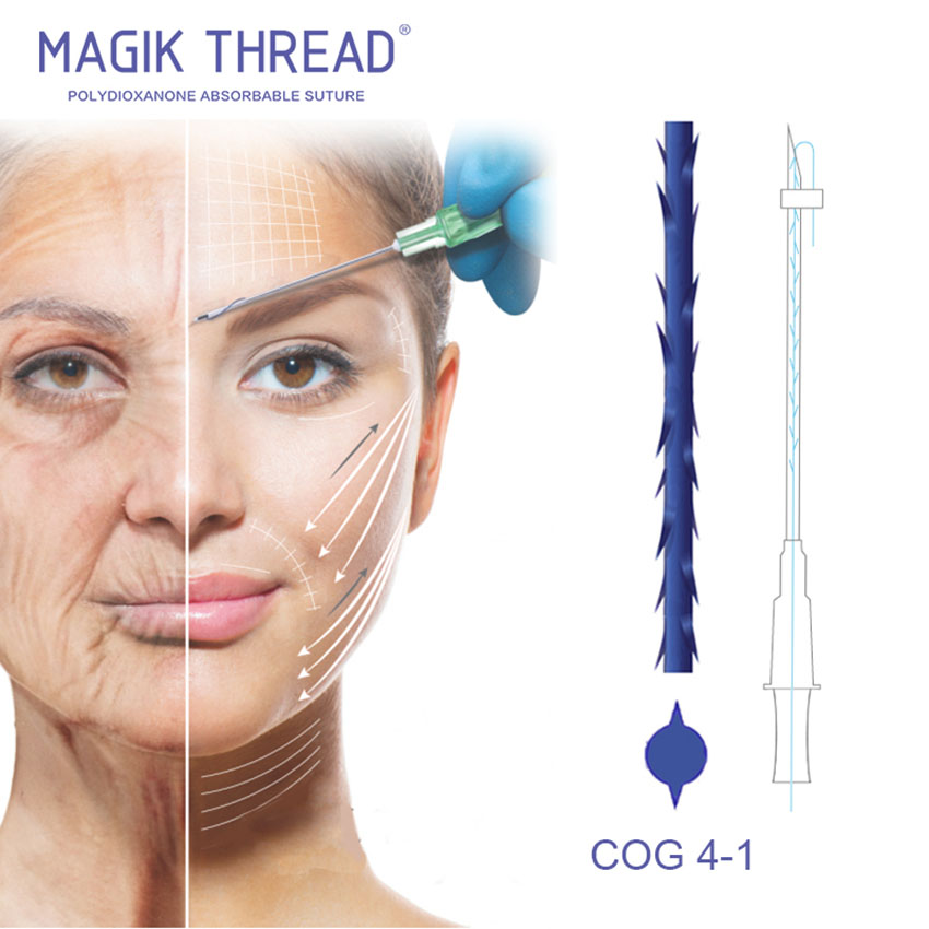 Cog Pdo Thread Manufacturer