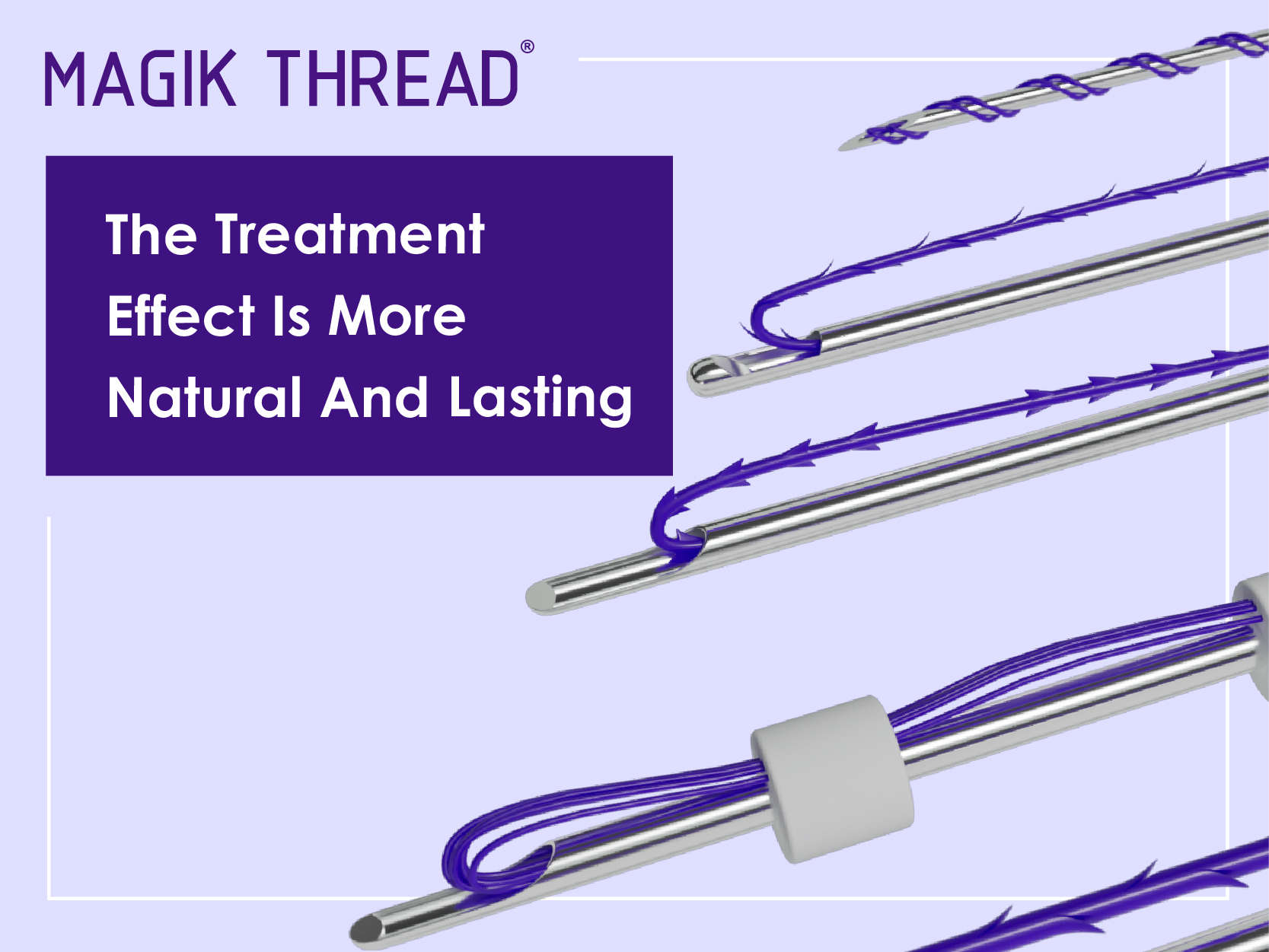 How many types of PDO threads exist how to choose (3)