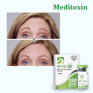 Nabota botulinum toxin for Anti Aging Online Supply