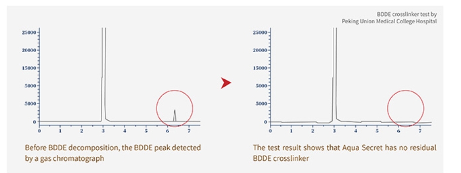 Macrolite dermal filler buttocks technology 3
