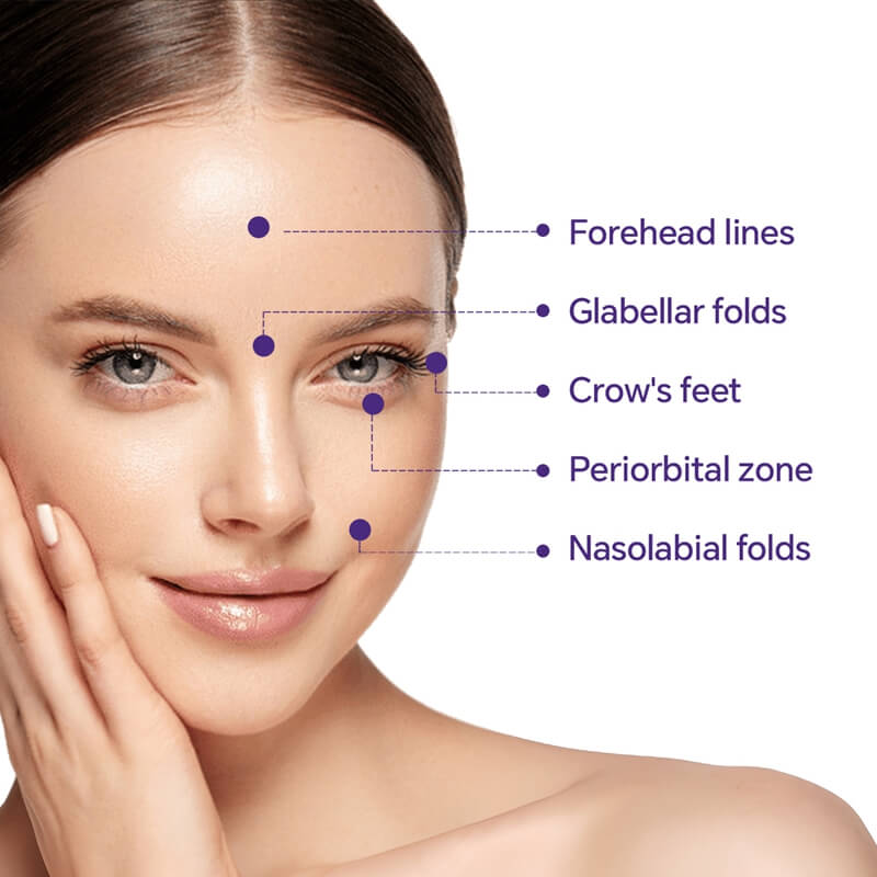 botulax treatment areas