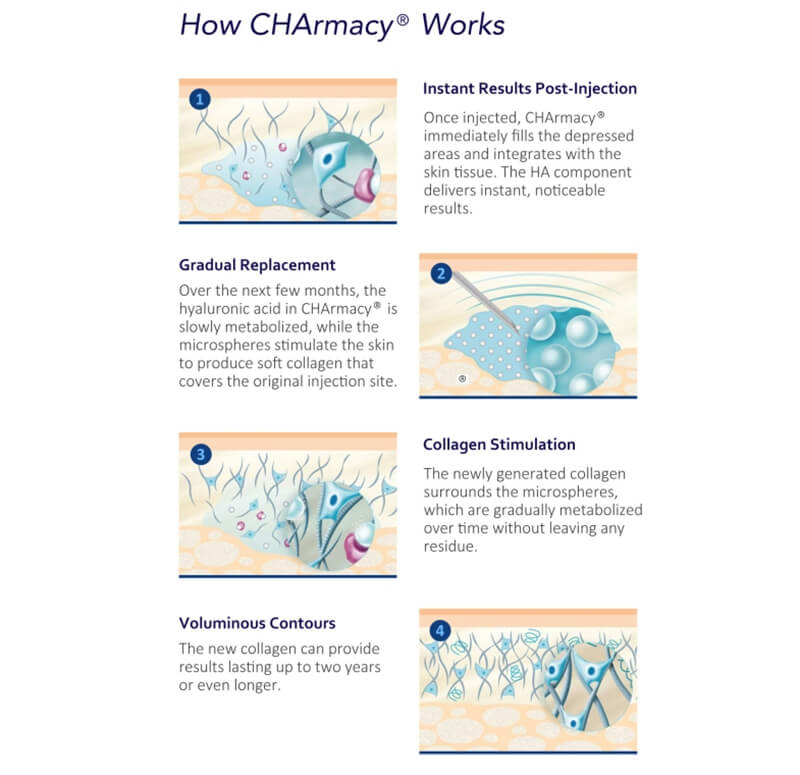 how charmacy caha filler works
